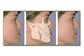 Cirurgia Buco-Maxilo-Facial